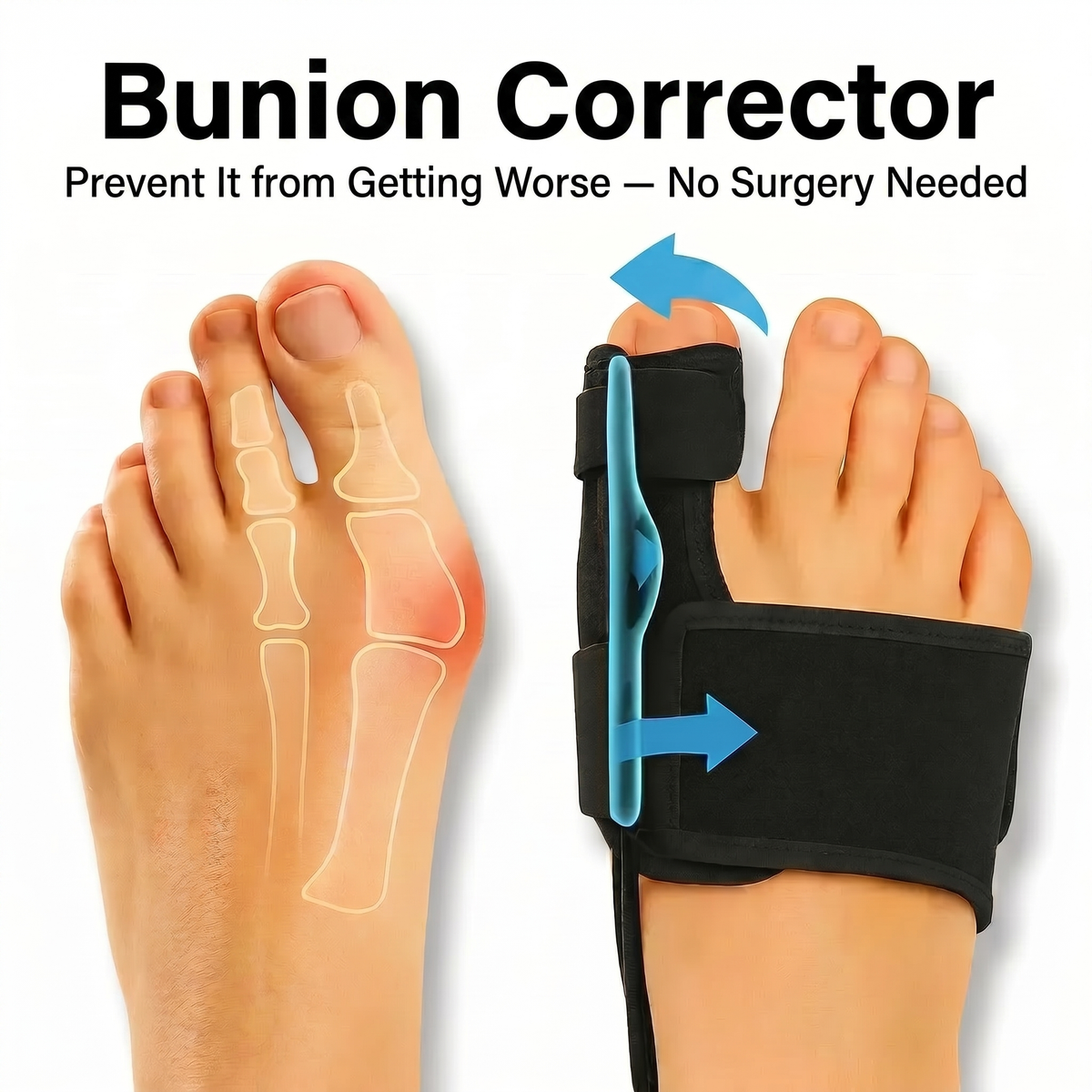 OrthoSoft™ Corrector de juanetes